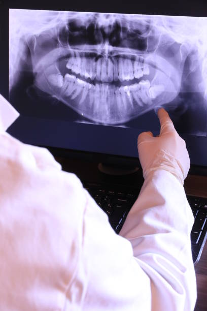 Best Broken or Chipped Tooth Repair in Wytheville, VA